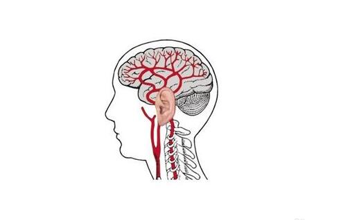 择思达斯经颅磁正规吗_导致脑血栓复发的几种原因