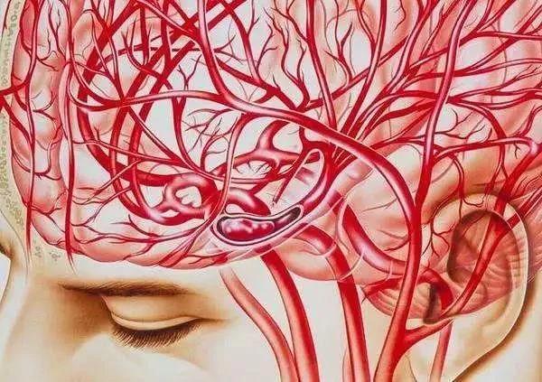 经颅磁 脑出血急救很简单，发现脑出血就能用