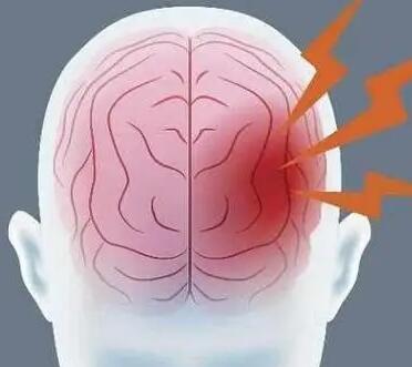 经颅磁的治疗_脑溢血有哪些信号提示