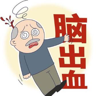 经颅磁家用版哪个最好?脑出血能不能完全康复