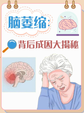 家用经颅磁如何挑选_脑萎缩进展速度快还是慢?